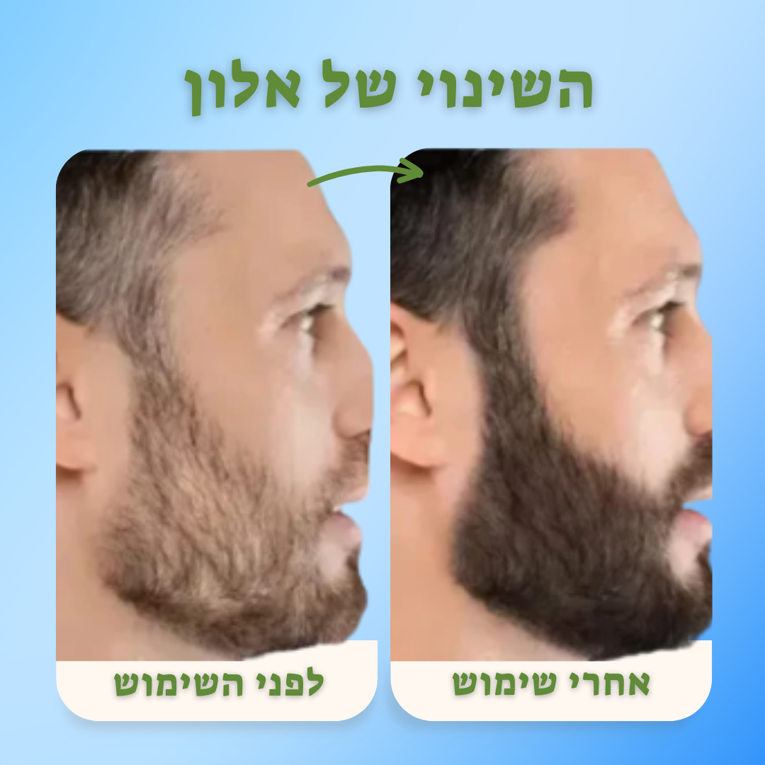 השיער צומח הבטחון גם Growit!