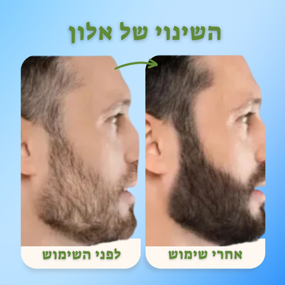 השיער צומח הבטחון גם Growit!