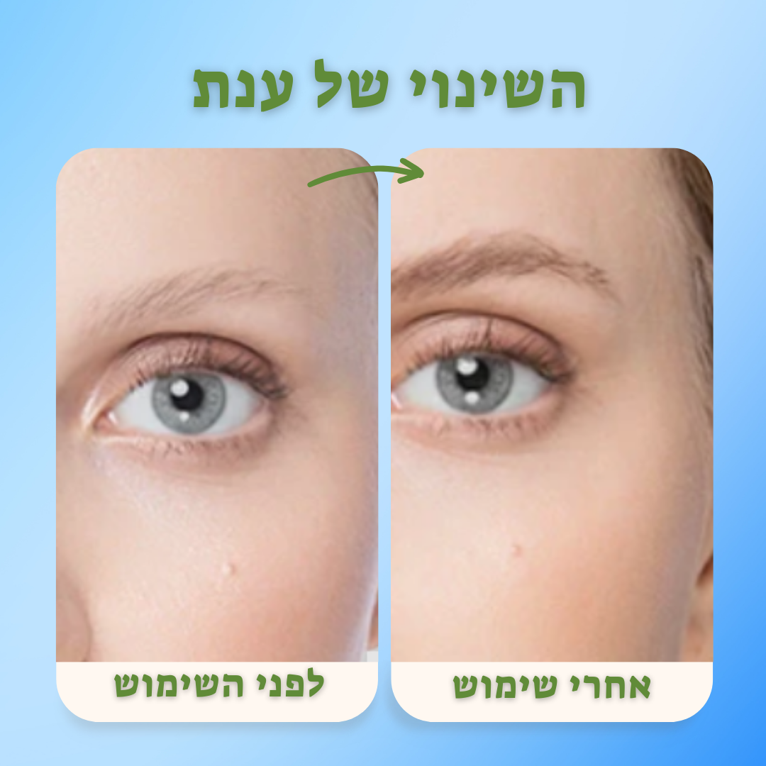השיער צומח הבטחון גם Growit!