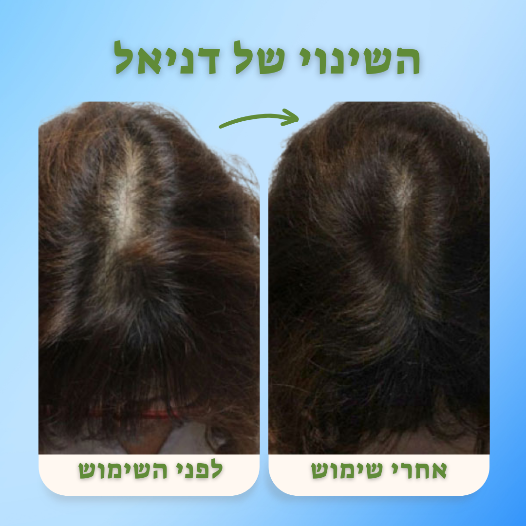 השיער צומח הבטחון גם Growit!